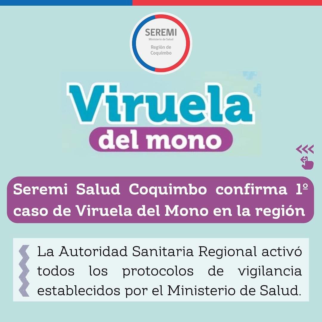 Autoridad Sanitaria confirma primer paciente con viruela del mono en la Región